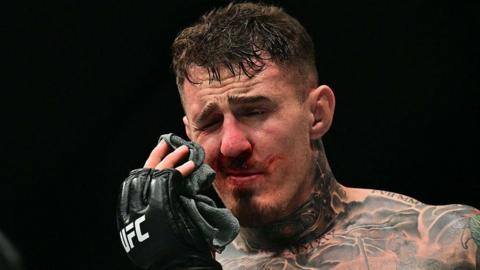 Tom Aspinall holds his hurt eye at UFC 321